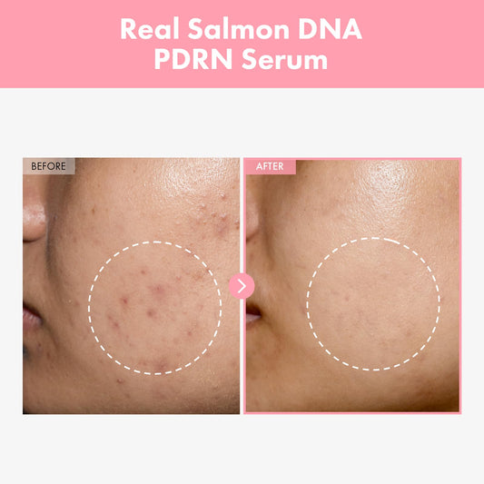 TOSOWOONG Pink Peptide 12 PDRN Serum – mit Lachs-DNA (PDRN 10.320 ppm), 12 Peptiden & Niacinamid, unterstützt ein gepflegtes, ebenmäßiges Hautbild, spendet Feuchtigkeit, Koreanische Kosmetik, 33ml