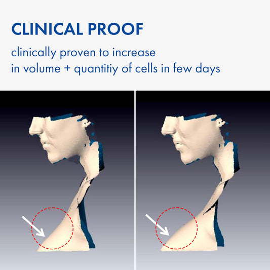 TOSOWOONG Volufiline Serum, 100% Sederma Volufiline-Konzentrat aus Frankreich – für mehr Volumen, straffere Haut, Glow-Boost und Glass-Skin Effekt, Pflege für Gesicht, Lippen und Körper, 11ml