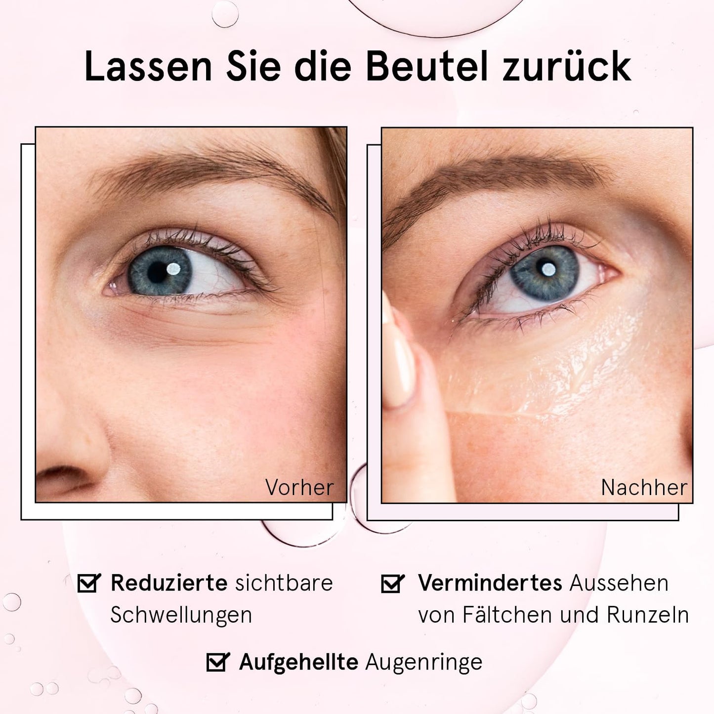 grace & stella, Augenroller mit Augencreme genen Falten und Augenringe mit Retinol & Koffein Augen-Roll-On mit Augencreme gegen Tränensäcke (15ml)
