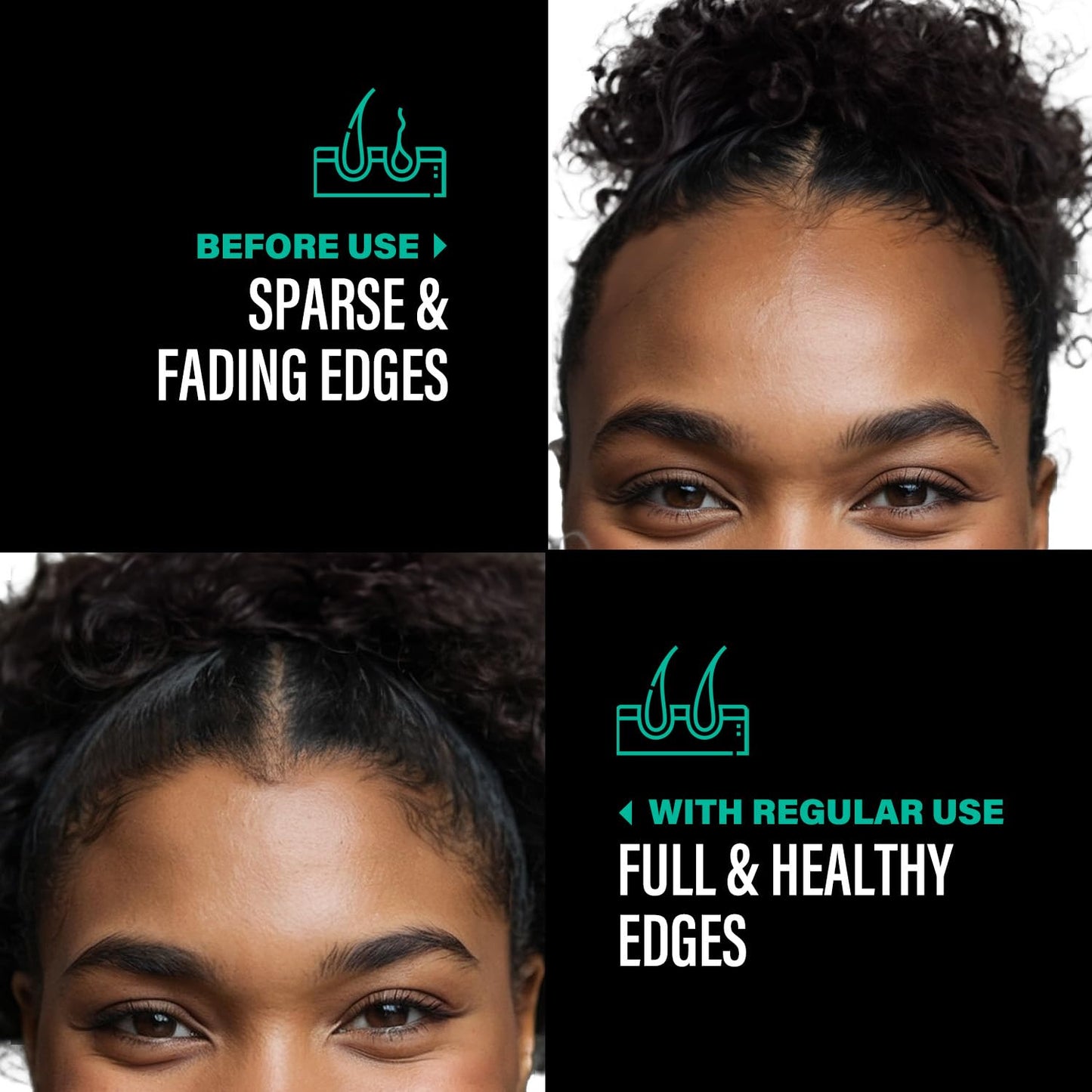 Organisches Batanaöl für Haarwachstum, Dr. Sebi Organic – 100 % unraffiniertes Batanaöl aus Honduras für volleres, dickeres und gesünderes Haar