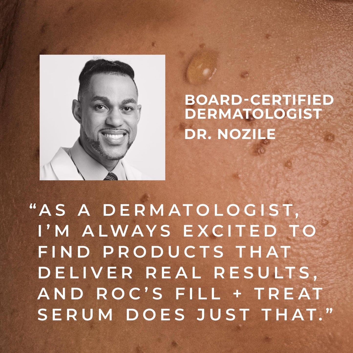 RoC Derm Correxion Fill + Treat Advanced Retinol Serum, Faltenfüller Behandlung mit Hyaluronsäure für Stirnfalten, Krähenfüße, elf Falten und Lachlinien, 15 ml